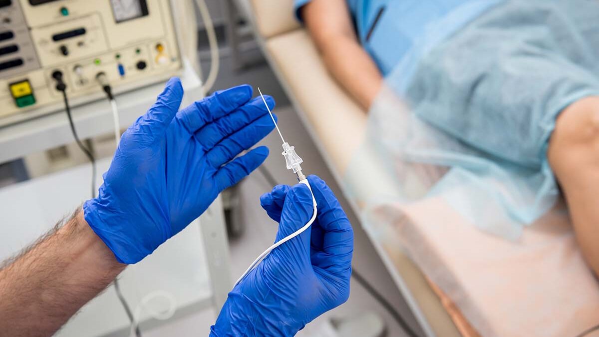 Who Is The Ideal Candidate For Radiofrequency Ablation?