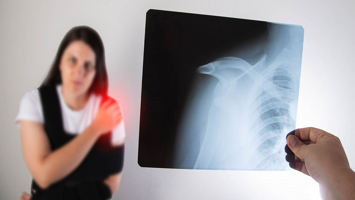 Treatment Options for a Dislocated Shoulder