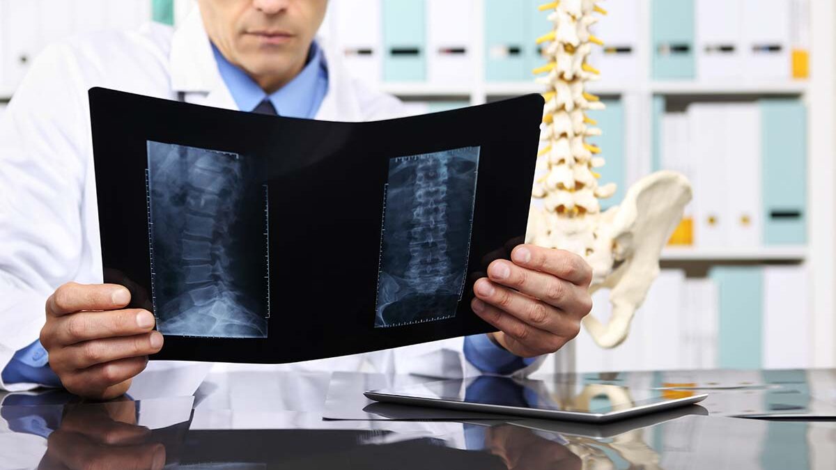 The Difference Between A Herniated & A Degenerative Disc