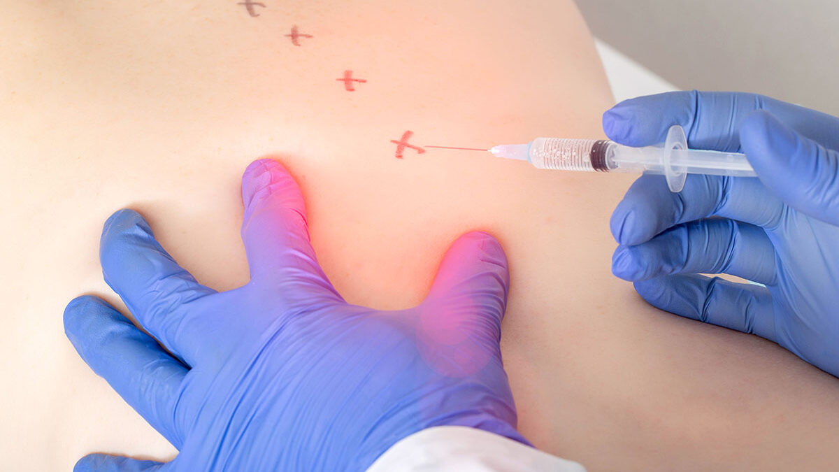 Can an Epidural Steroid Injection Work for Your Inflammation?