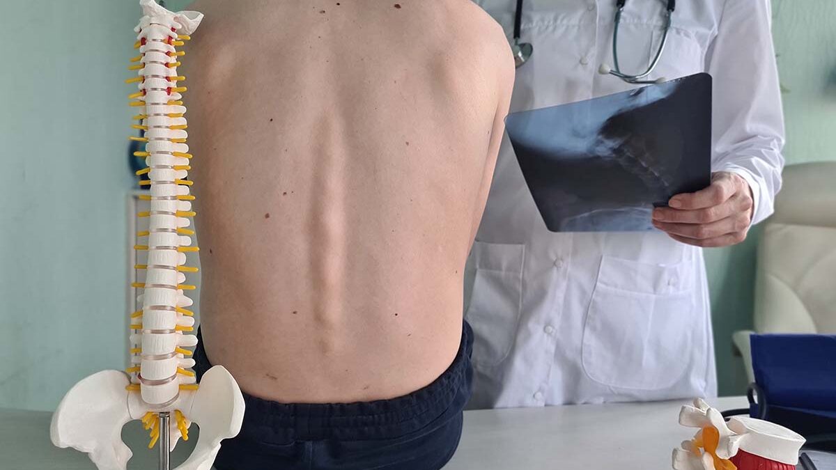 What Questions Should I Ask My Neurosurgeon Before A Spine Surgery?