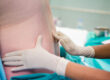 Why Are Epidural Steroid Injections Used for Post-Surgical Treatment?