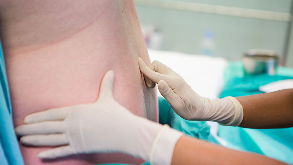 Why Are Epidural Steroid Injections Used for Post-Surgical Treatment? Why Are Epidural Steroid Injections Used for Post-Surgical Treatment?