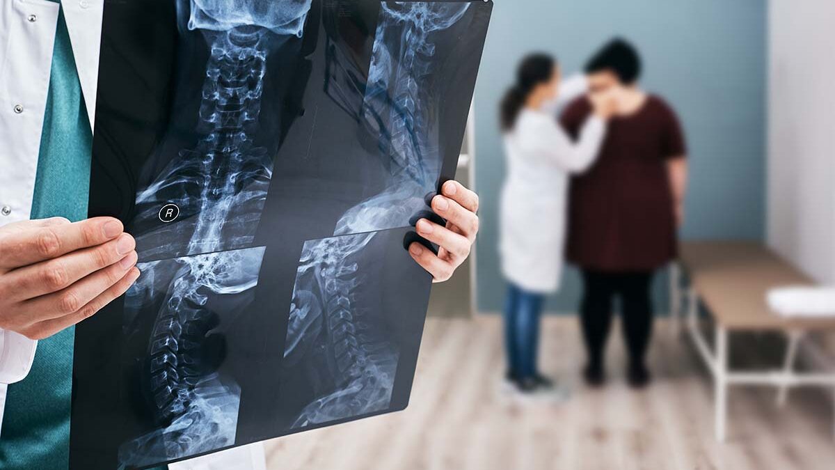 I Have Scoliosis. Is a Spine Surgeon the Right Choice for Me?