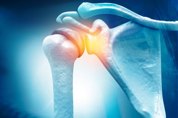 What is a Rotator Cuff Tear?