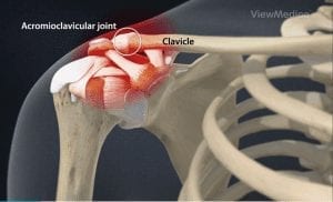 AC Joint Pain
