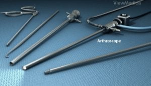Arthroscope video