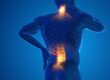The Pain Scale of Back Pain