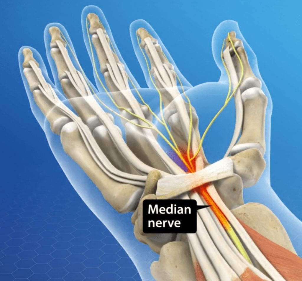 Median Nerve