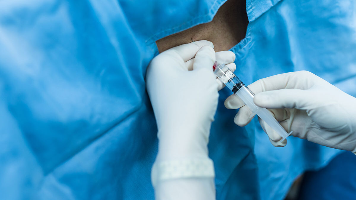 Why Should You Get Epidural Steroid Injections