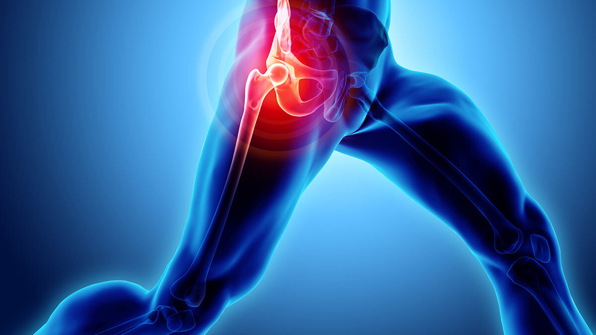What You Should Know About Hip Pain