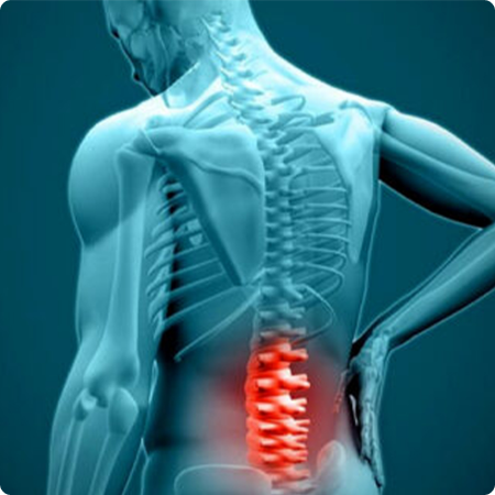 lower-back-pain-img