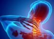 Understanding Neck and Upper Limb Pain: Prevalence, Risk Factors, and Myths