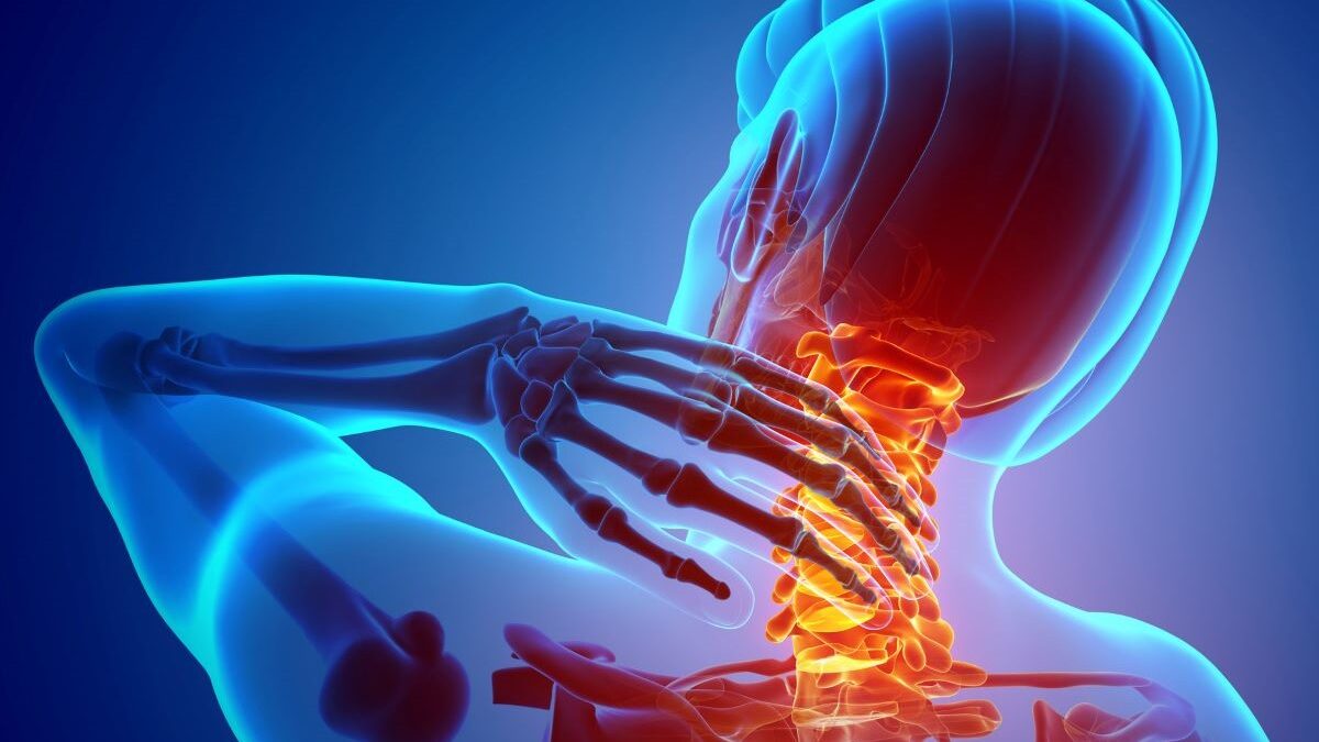 Understanding Neck and Upper Limb Pain: Prevalence, Risk Factors, and Myths