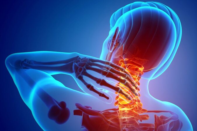 Understanding Neck and Upper Limb Pain: Prevalence, Risk Factors, and Myths