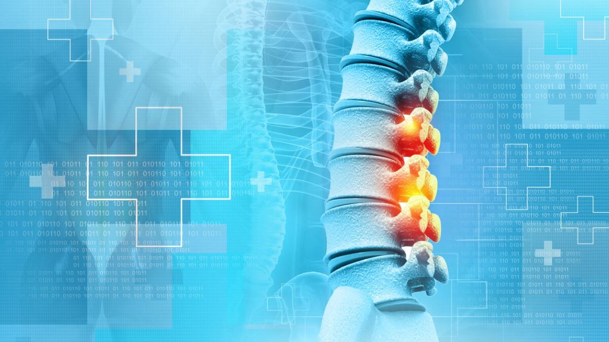 Finding Relief: Alternatives to Back Surgery