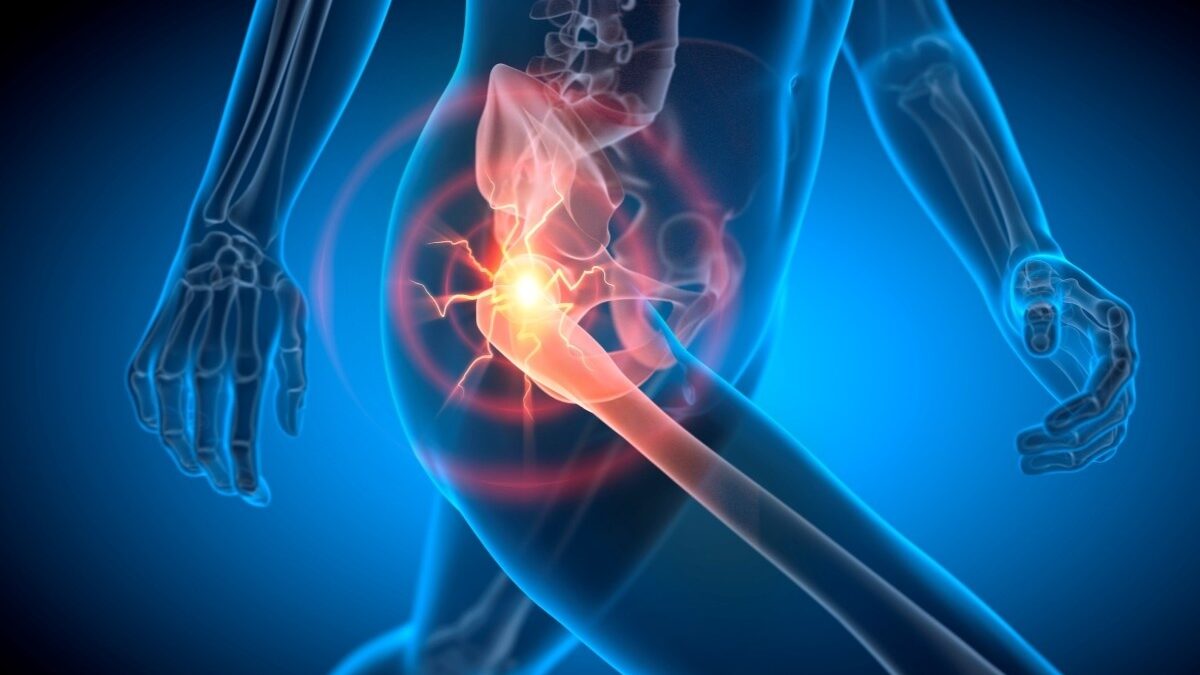 Why Does My Hip Hurt? When To Seek Help
