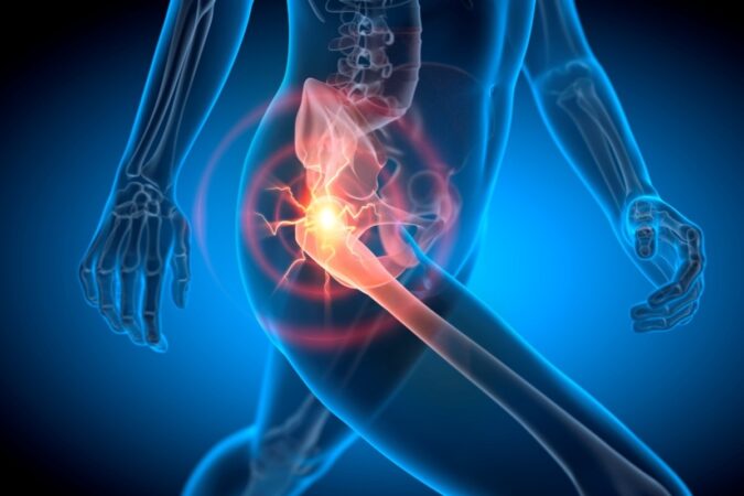 Why Does My Hip Hurt? When To Seek Help