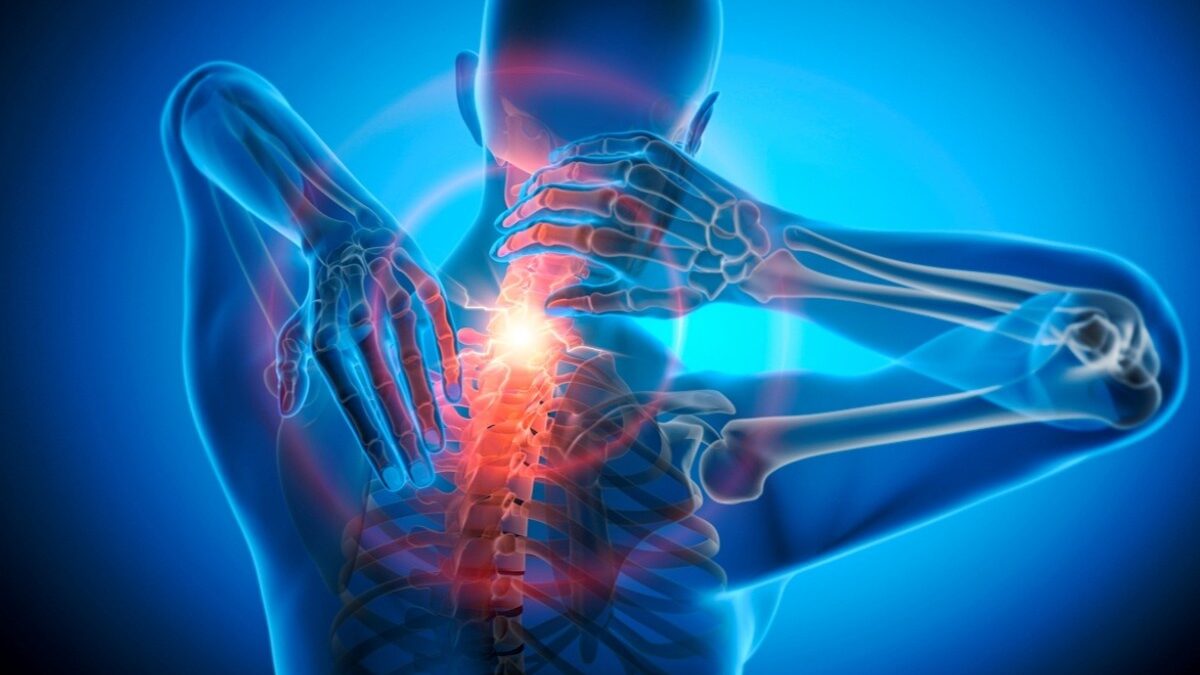 Do You Have a Pinched Nerve? Foraminal Stenosis Explained