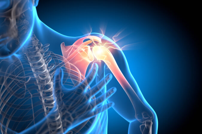What's Causing Pain Between My Shoulder Blades?